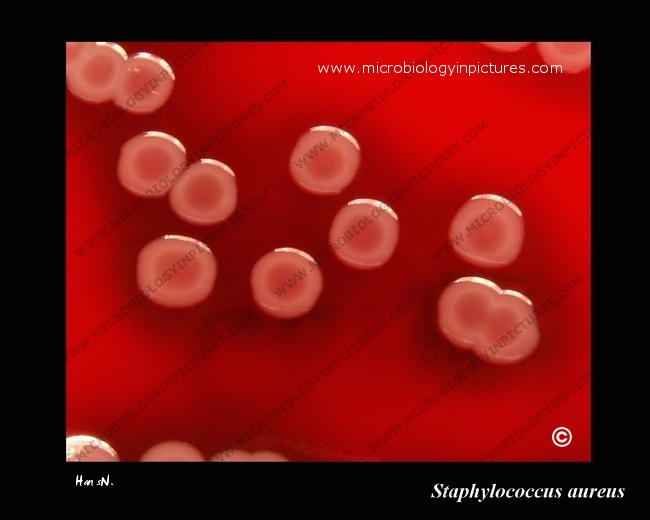 s.aureus streaked on blood agar